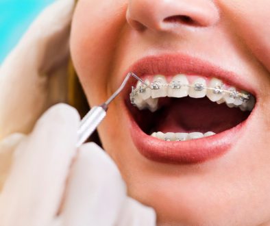 Przewodnik ortodoncji – najpopularniejsze pytania i odpowiedzi