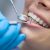Ekstrakcja zęba stałego - kiedy jest konieczna?